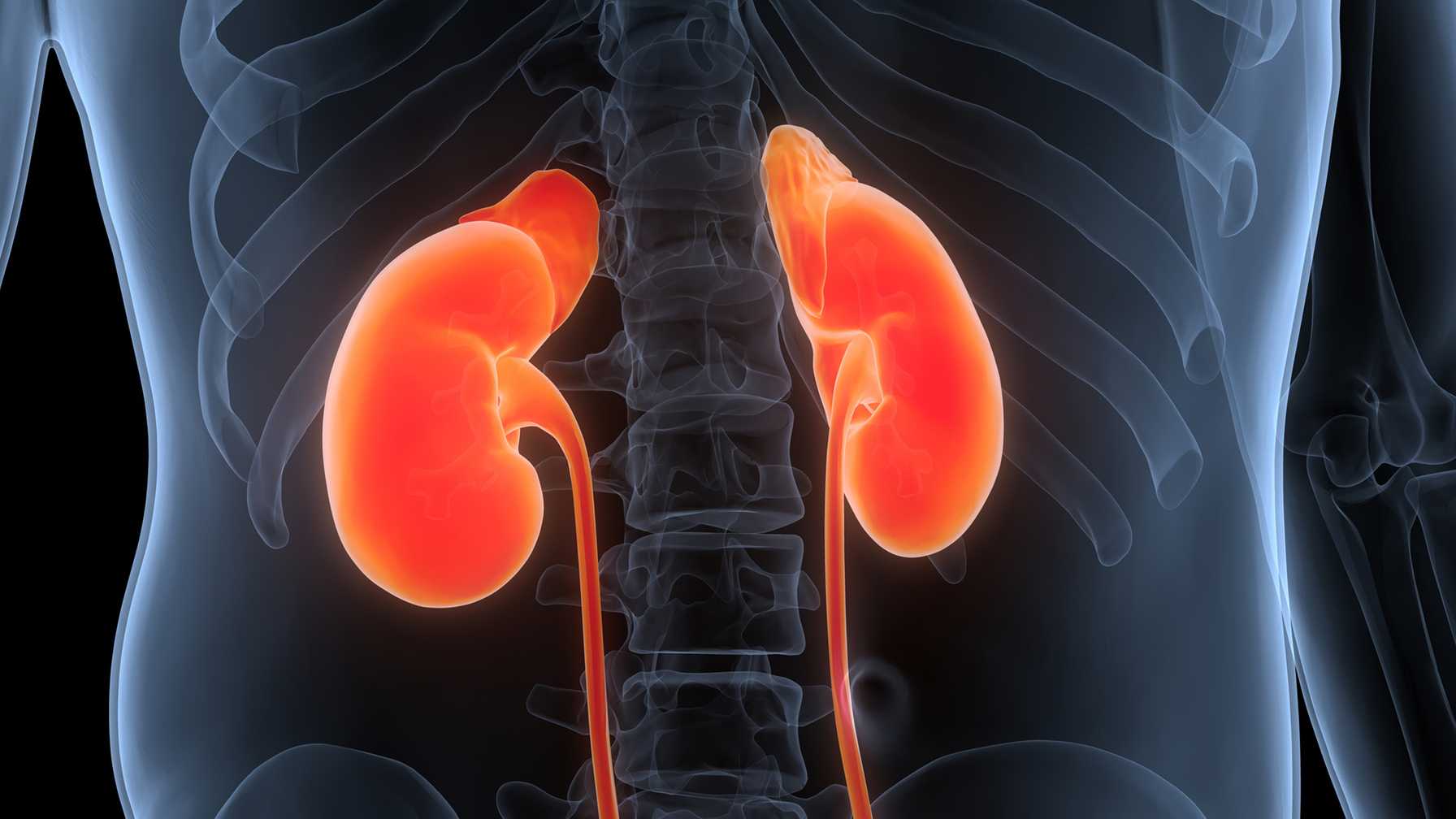 Metabolic Acidosis in Pediatric Kidney Transplant Recipients