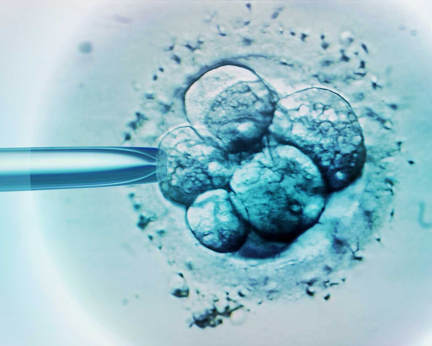 Comparing Reproductive Outcomes Between Conventional In Vitro Fertilization and Nonindicated Intracytoplasmic Sperm Injection in Autologous Embryo Transfer Cycles