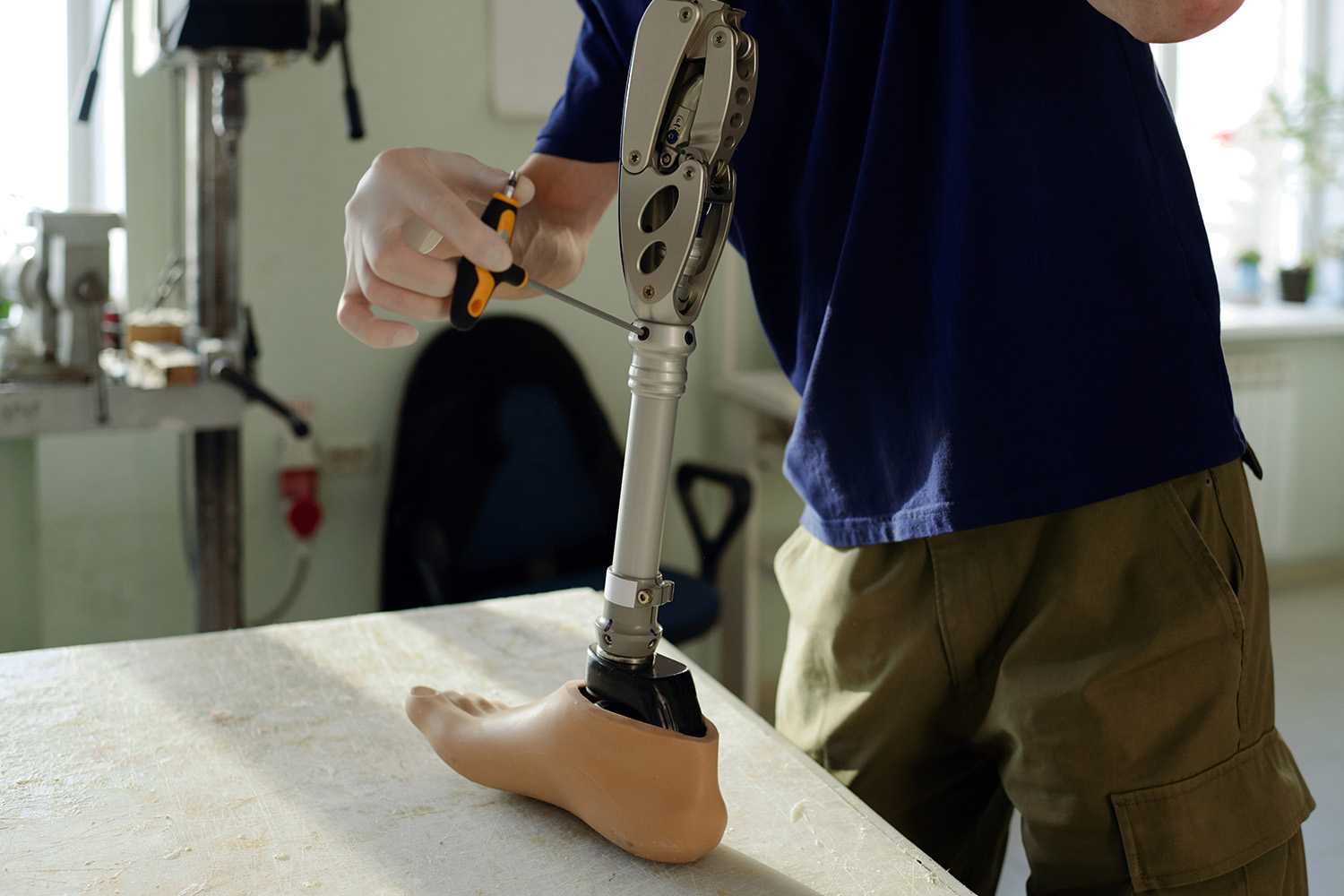 Approaches to Prosthetic Limb Restoration in Resource-Limited Settings/Countries: 3 Dimensional Printing