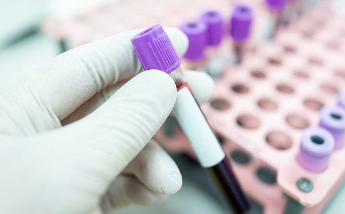 Paradoxical Elevation of Both Serum B12 and Methylmalonic Acid Levels in Assessing B12 Status in Children With Short-Bowel Syndrome