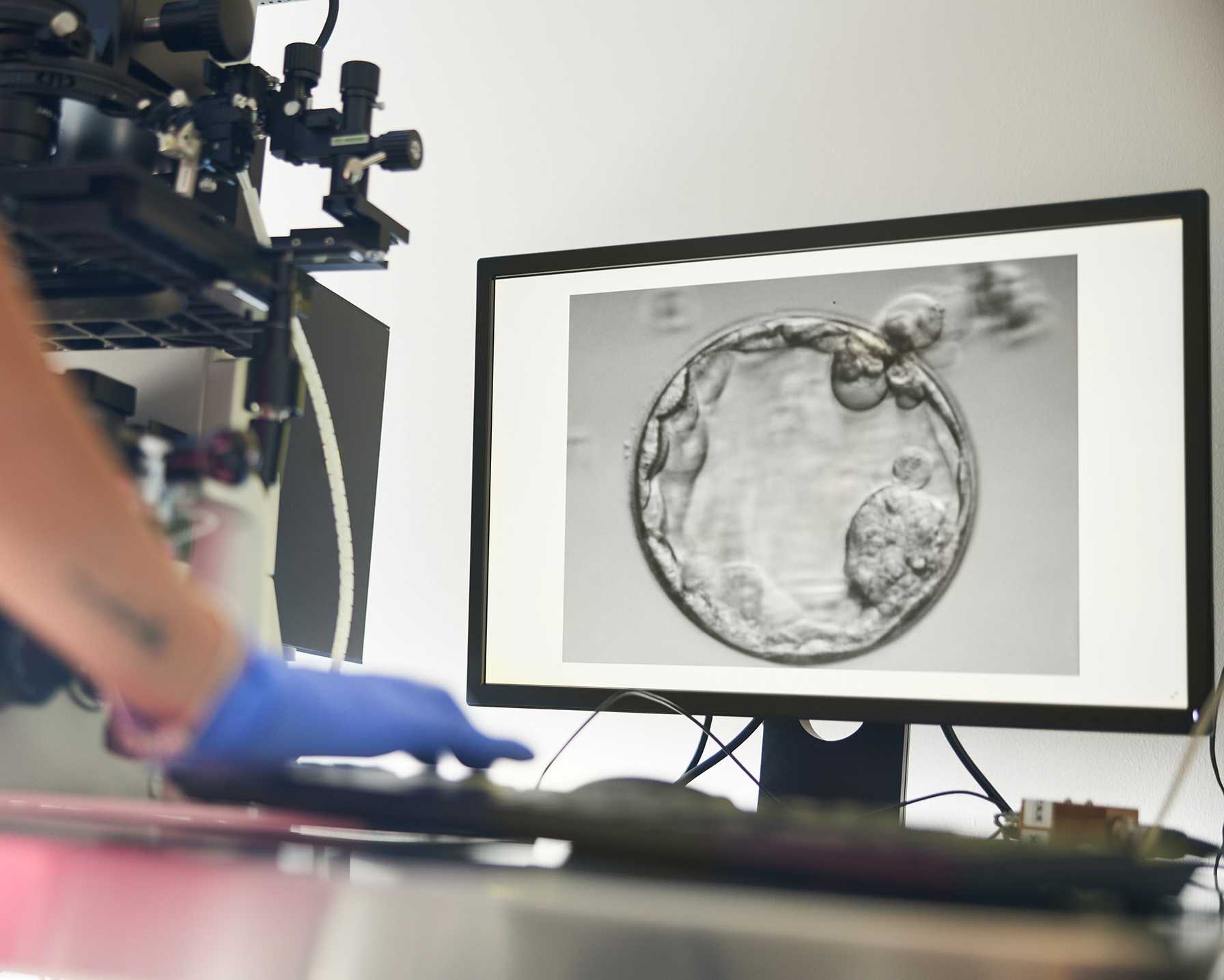 Obstetric and Neonatal Outcomes After Transferring More Than One Embryo in Patients With Preimplantation Genetic Testing