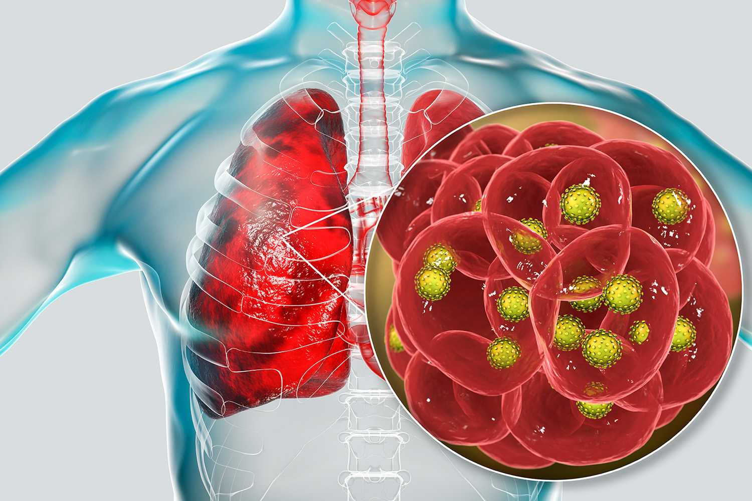 Crosstalk Between CD4+ T Cells and Airway Smooth Muscle in Pediatric Obesity-related Asthma