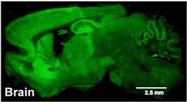 Selective Expression of Mutant Huntingtin During Development Recapitulates Characteristic Features of Huntington’s Disease