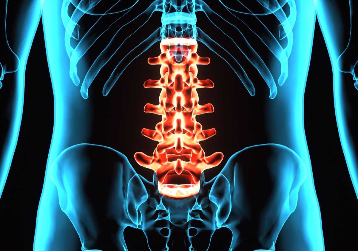 Lumbar Medial Branch Block Volume-dependent Dispersion Patterns as a Predictor for Ablation Success: A Cadaveric Study