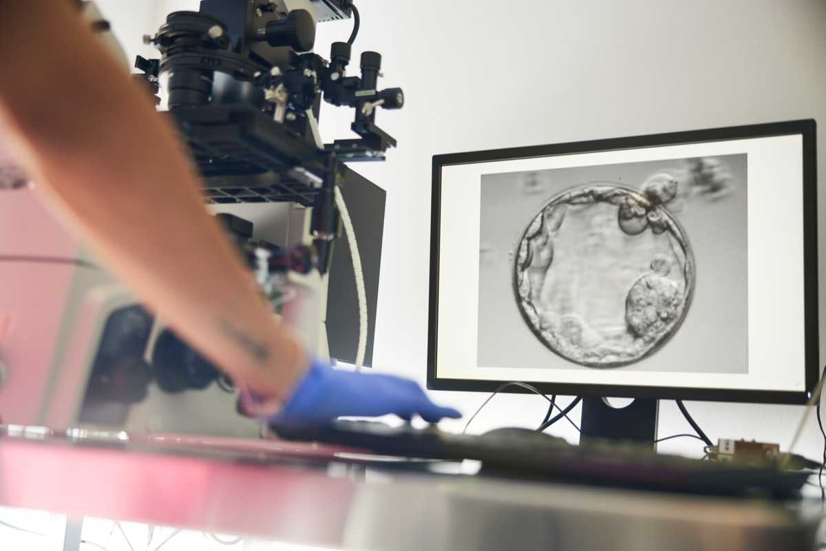 Trophectoderm biopsy is associated with lower risks of moderate to extreme prematurity and low birthweights: a national registry cohort study of singleton livebirths from frozen-thawed blastocyst transfers