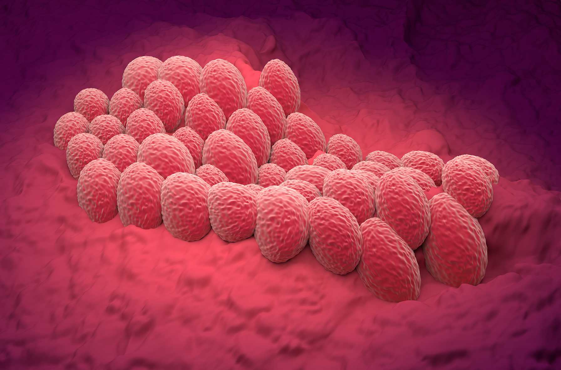 Efficacy and Safety of Dostarlimab in Combination with Chemotherapy in Patients with dMMR/MSI-H Primary Advanced or Recurrent Endometrial Cancer in a Phase 3, Randomized, Placebo-controlled Trial