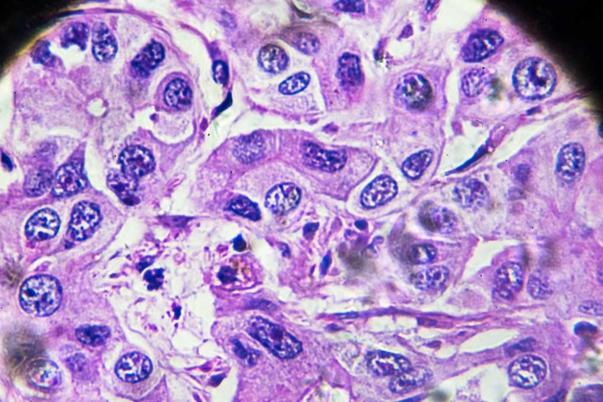 Centers with More Therapeutic Modalities Are Associated with Improved Outcomes for Patients with Hepatocellular Carcinoma
