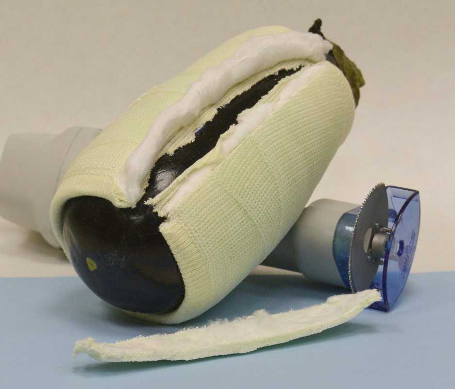 Empty fiberglass cast that has been opened