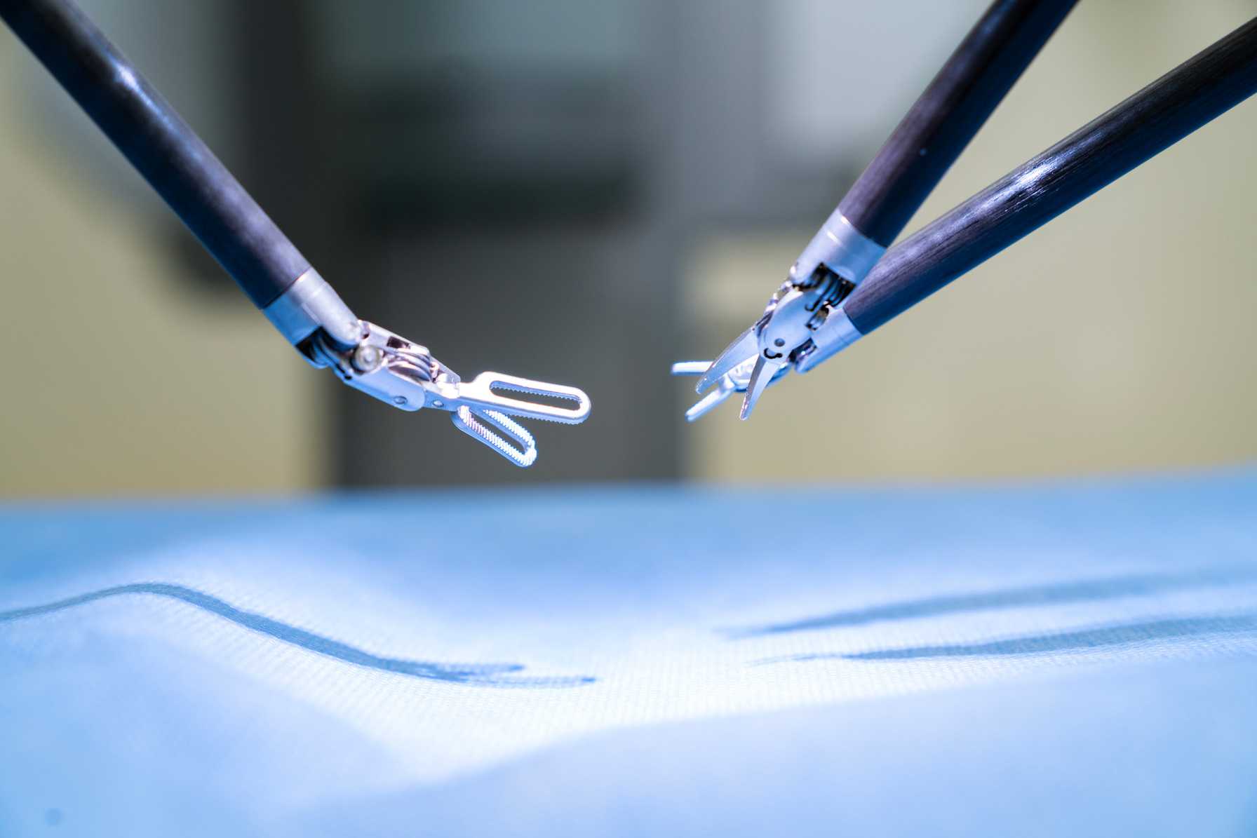 Spontaneous Abdominal Wall Endometriosis: Minimally Invasive Surgery for Excision and Repair