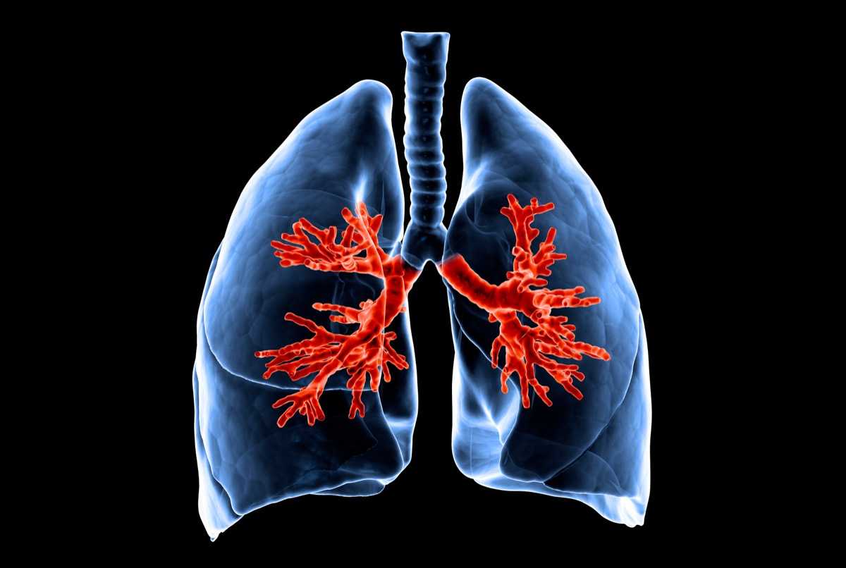 Noninvasive Ventilation for Preoxygenation During Emergency Intubation