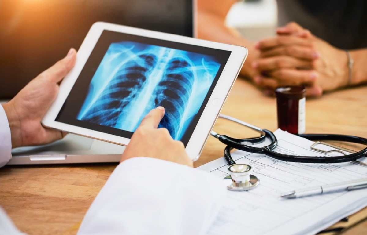 Cardiac Irradiation Predicts Activity Decline in Patients Receiving Concurrent Chemoradiation for Locally Advanced Lung Cancer