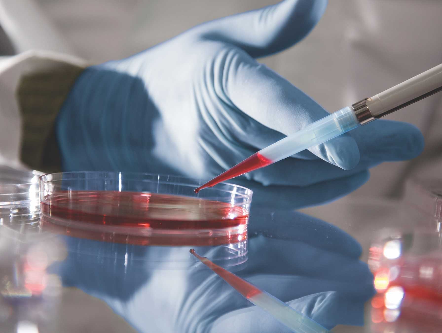Adjuvant Chemotherapy Guided by a 21-Gene Expression Assay in Breast Cancer