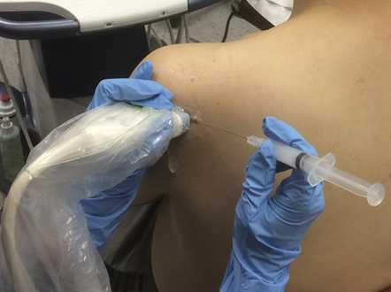 Point-of-Care Ultrasonography Findings and Care Use Among Patients Undergoing Ultrasound-Guided Shoulder Injections