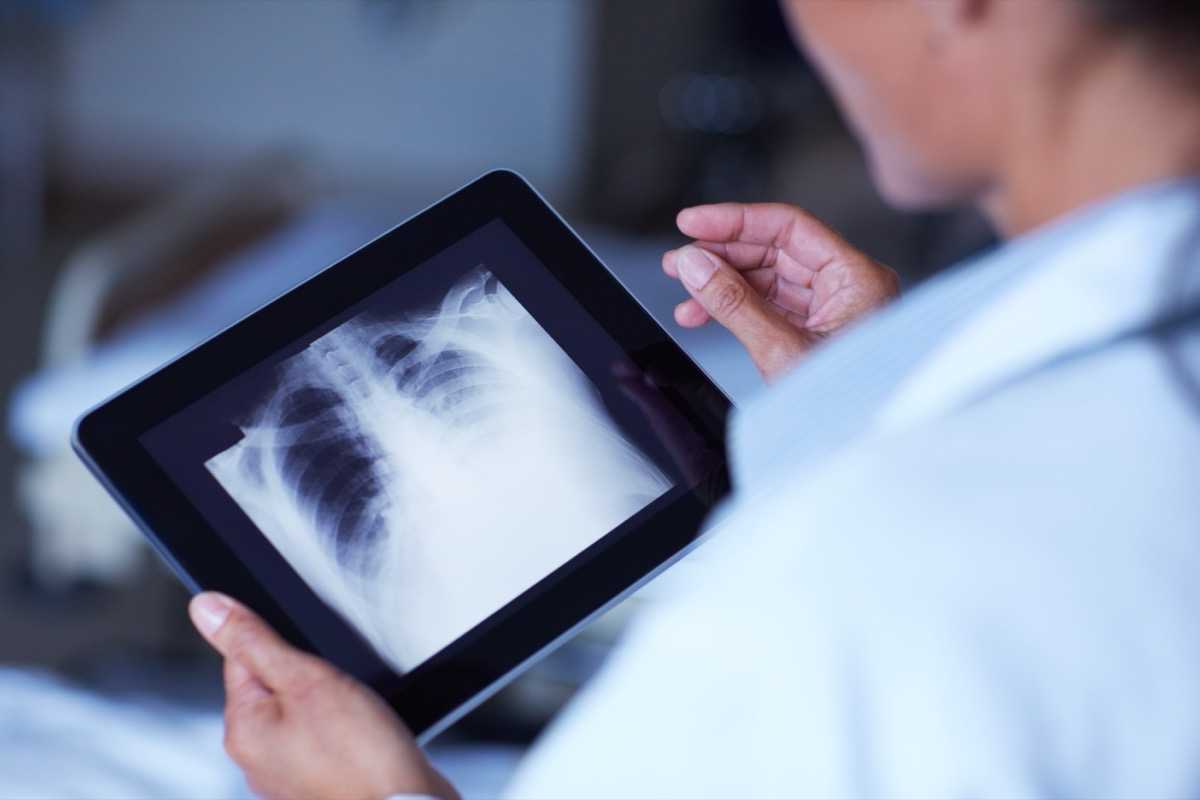 The Role of Chest Imaging in Patient Management during the COVID-19 Pandemic: A Multinational Consensus Statement from the Fleischner Society