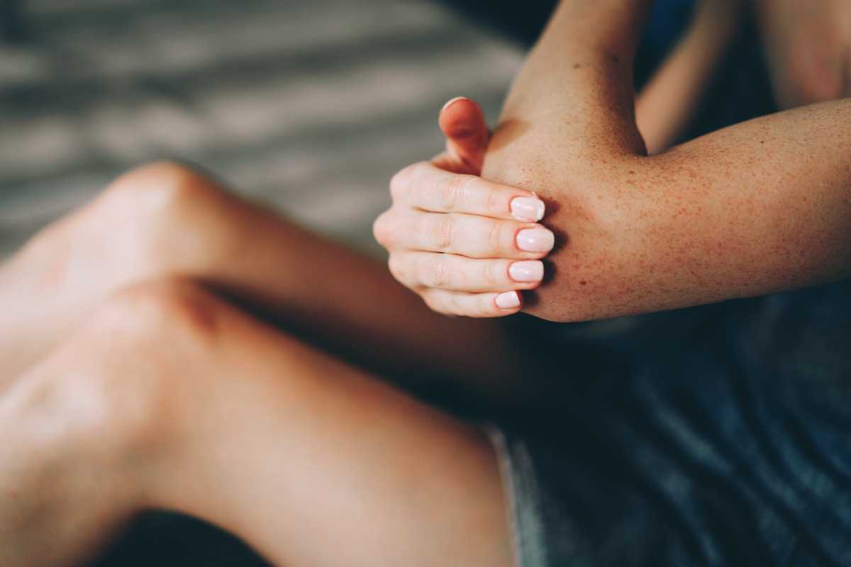 Dual immunomodulator therapy with adalimumab and upadacitinib to treat recalcitrant hidradenitis suppurativa