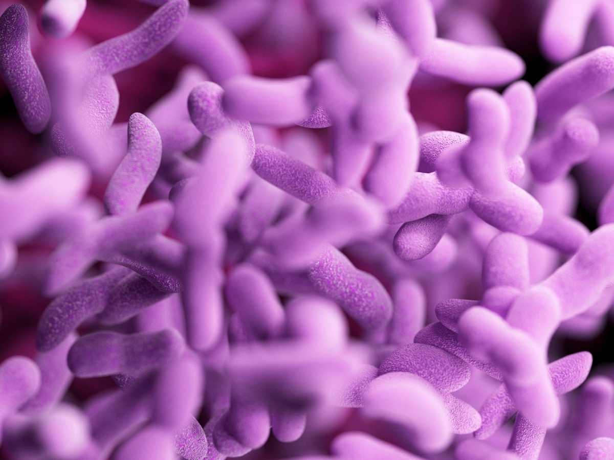 Bacterial and Fungal Coinfections in Covid-19 Patients Hospitalized During the New York City Pandemic Surge
